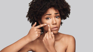 How to Reduce Acne Naturally: Answers to Your 10 Most Burning Questions