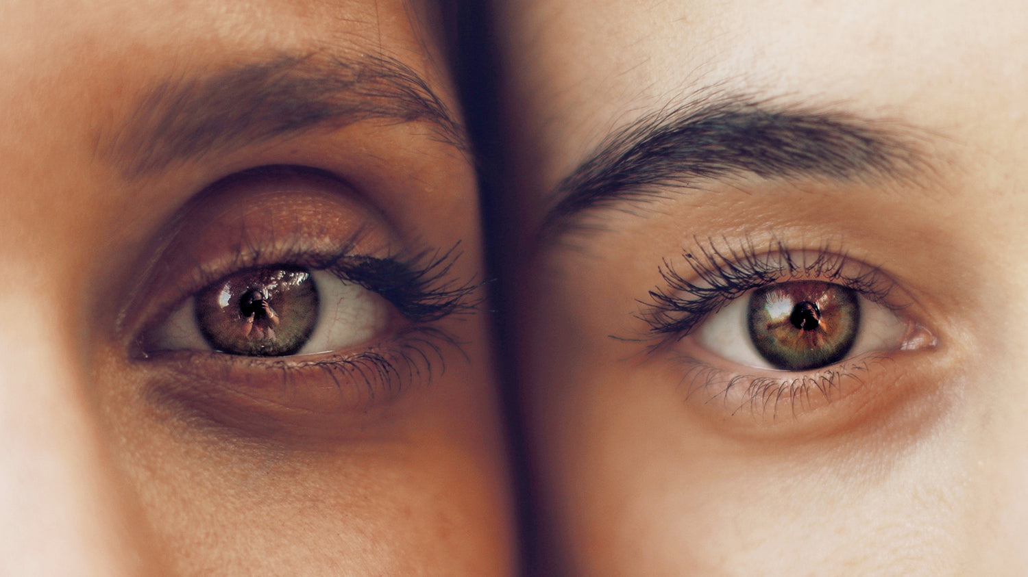 Why Do I Have Dark Circles Around My Eyes?