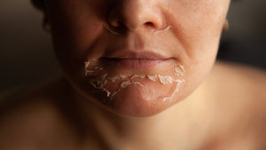 Bundles for Sun-Damaged Skin